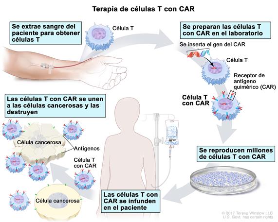 terapia células T con CAR