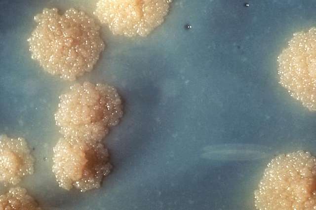 Mycobacterium tuberculosis sobre un medio de cultivo